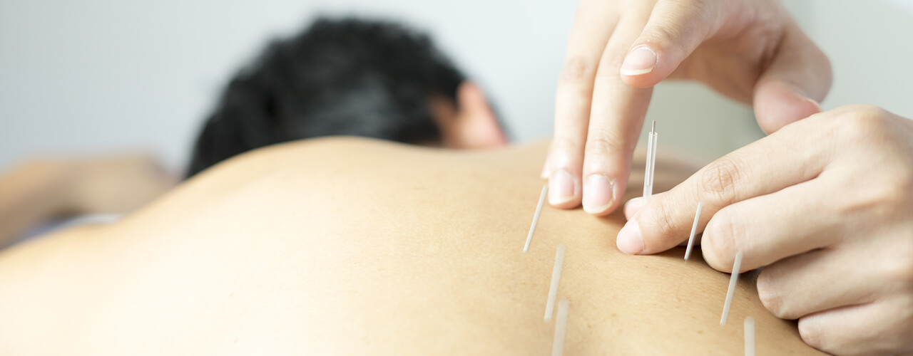 acupuncture lake country physiotherapy