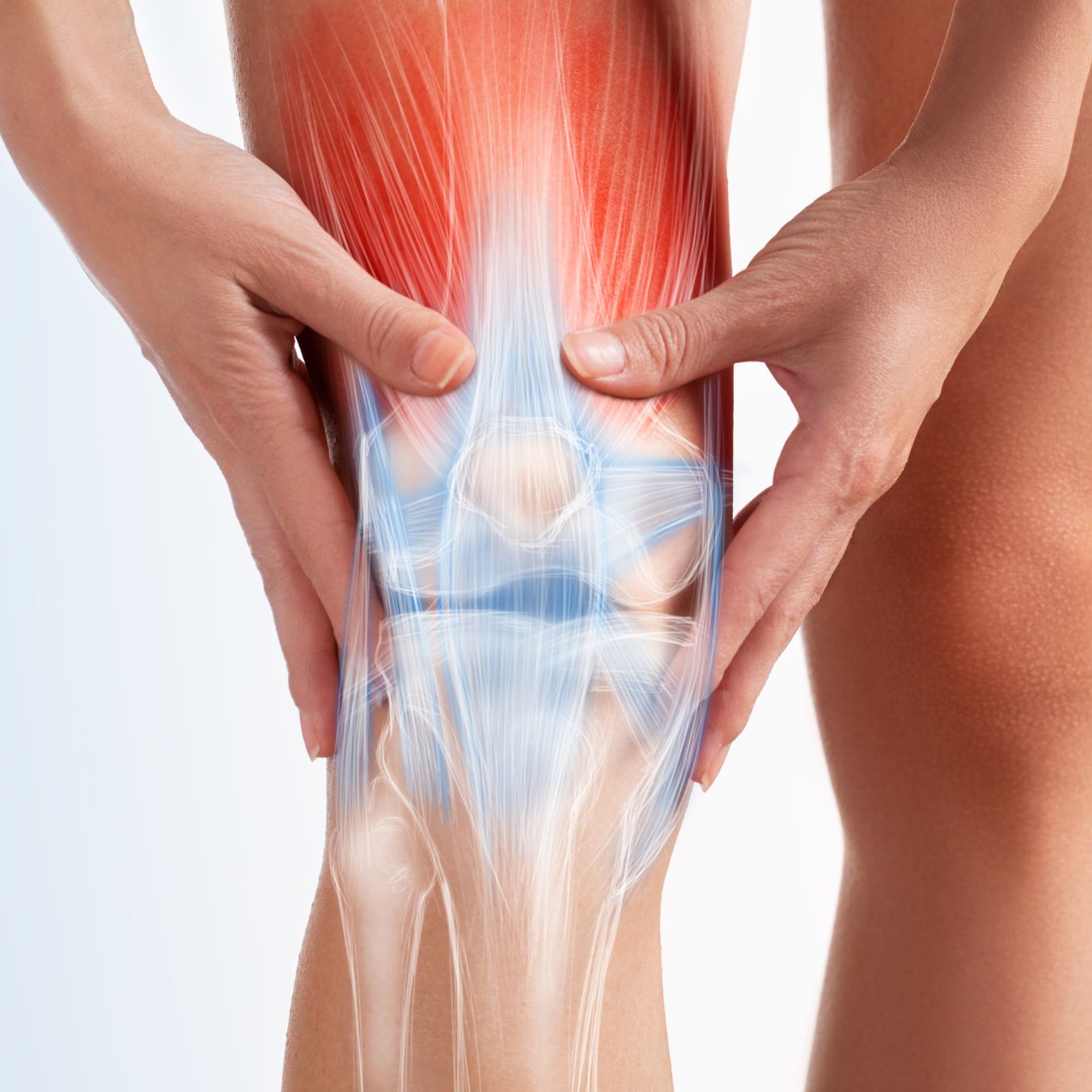 Arthritis